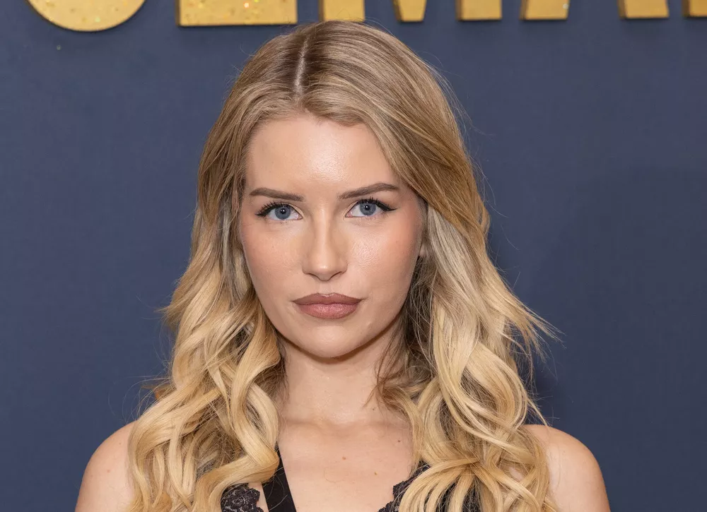 Сестра Кейт Мосс удалила татуировку на лице