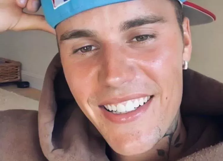 Помолитесь за меня: у Джастина Бибера парализовало половину лица